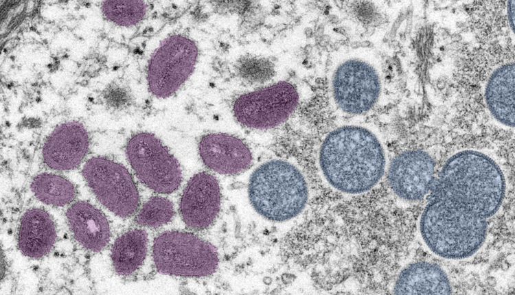 Nine monkeypox cases now reported in seven states, and CDC urges awareness